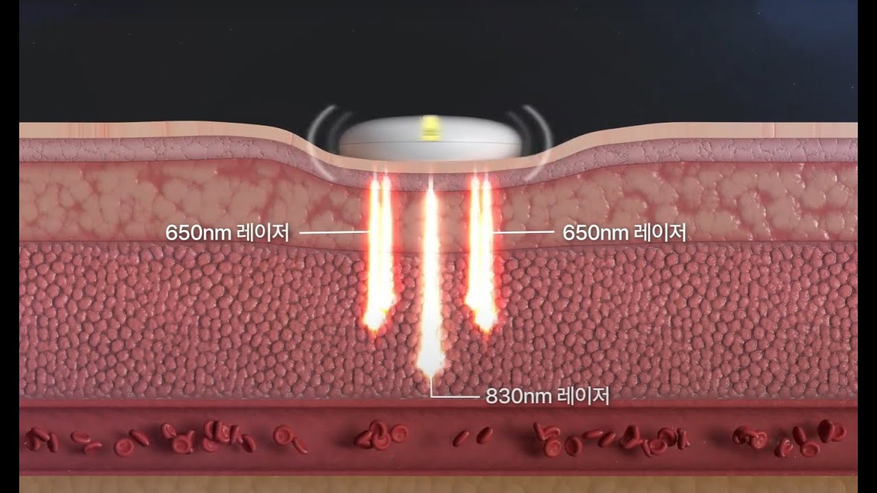 종합분야 기술영상
