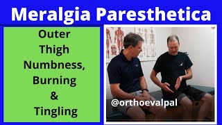 Meralgia Paresthetica (Outer thigh numbness, burning and tingling)
