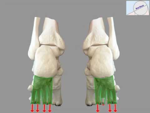 comment soigner rupture plaque plantaire