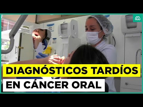 Ahora Salud | Diagnósticos tardíos en cáncer oral - Así es la nueva receta médica electrónica