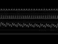 Mega Man Xtreme GBC Chill Penguin Stage Oscilloscope View