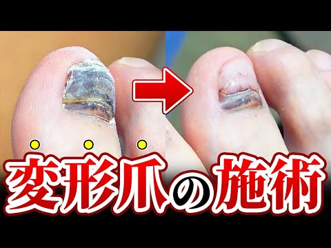 施術動画3