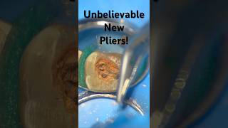 You need THESE pliers for ENDO