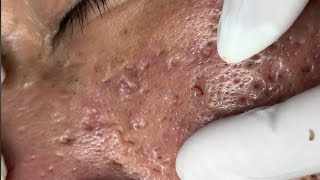 When he was young, his skin was severely inflamed 😢