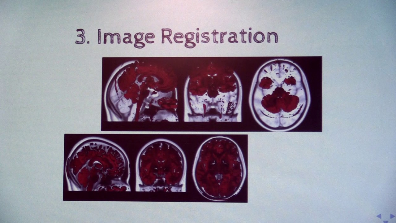 Data Analysis in MRI and PET/MRI Neuroimaging - Davide Poggiali