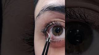 eye fishing 🎣 eye mucus removal. #eyes