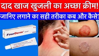 fourderm cream uses in hindi | best cream for ringworm, scabies and itching! | fourderm creame | ...