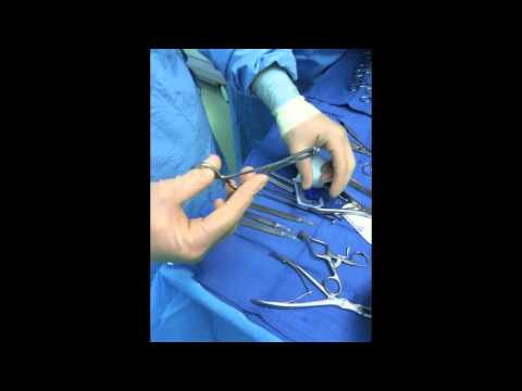 Toe Shortening Surgery with "Smart Toe" Implant