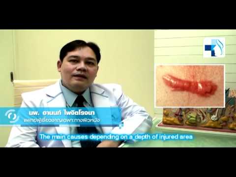 Neurodermatitis คันถอน ปัญหาผิวหูดและกลาก