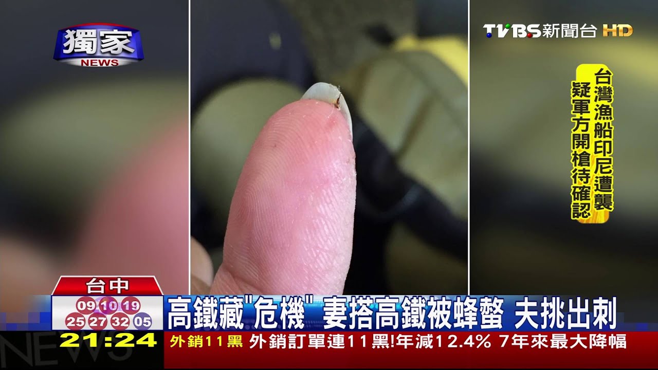 獨家／高鐵藏「危機」！妻搭高鐵被蜂螫　夫挑出刺