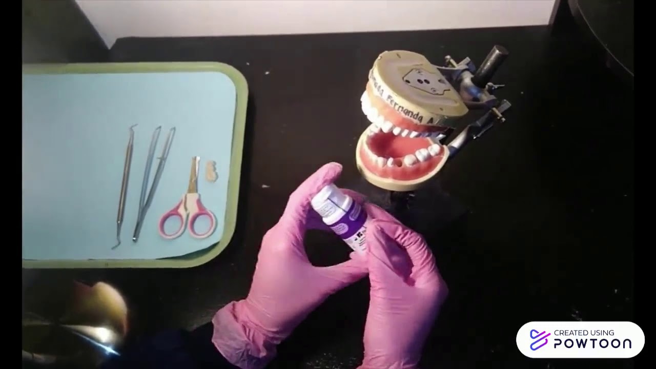 colocacion hilo retractor