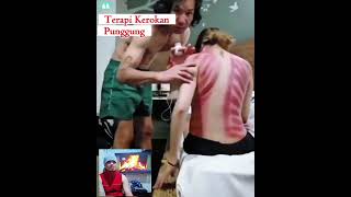 Download lagu Teknik Kerokan Tradisional: Meningkatkan Kesehatan dan Kecantikan mp3 Download lagu Teknik Kerokan Tradisional: Meningkatkan Kesehatan dan Kecantikan mp3