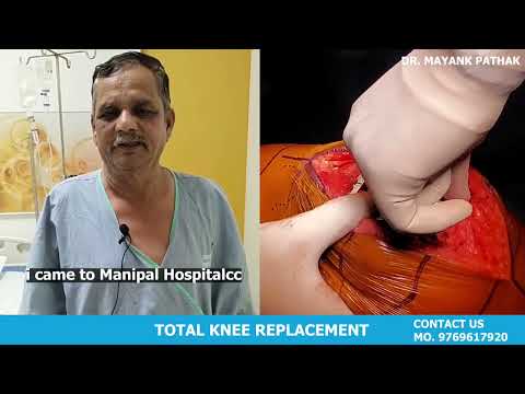 Transformative Benefits of Knee Replacement | Dr. Mayank Pathak