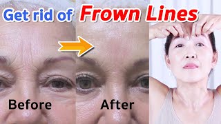 How to Get rid of Frown Lines, Reduce Wrinkles between eyebrows | NO TALKING | Facial Massage