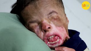 Download lagu Born Without Skin (So They Grew Him Some in a Lab) mp3 Download lagu Born Without Skin (So They Grew Him Some in a Lab) mp3