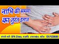 नाभि डिगना का इलाज NavalDisplacement NaturalTreatment Acupuncture Acup