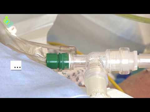 Zurück ins Leben - Analgosedierung