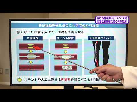 看護学科 20230708『閉塞性動脈硬化症の外科手術』心臓血管外科：坂本 大輔 講師