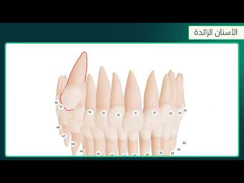 مخططات الأسنان ثلاثية الأبعاد والرسوم البيانية المتقدمة | إنفينت ميديكال