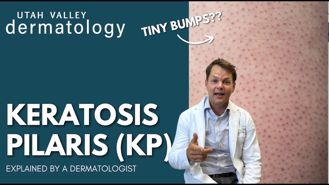 What Are Those Tiny Bumps On Your Skin? | Utah Valley Dermatology