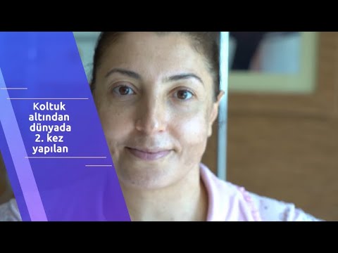 KOLTUK ALTINDAN DÜNYADA 2.KEZ YAPILAN REDO MİKSOMA AMELİYATI..