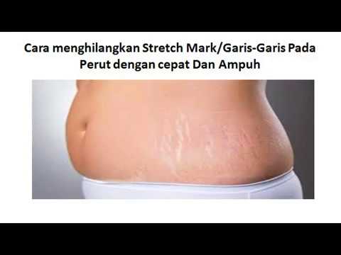 Menghapus sisi dari paha Menghilangkan lemak dari sisi Massager