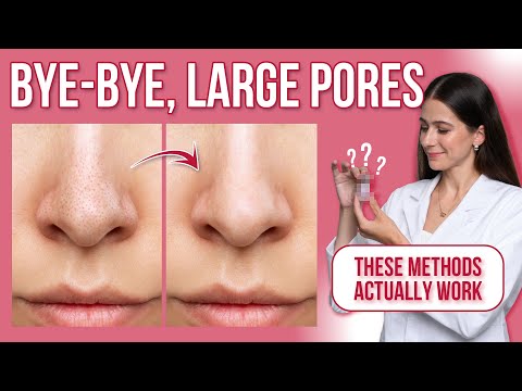 How to shrink pores on your face?