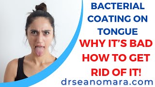 Bacterial Coating on Tongue: Why it’s Bad, How to Get Rid of It!