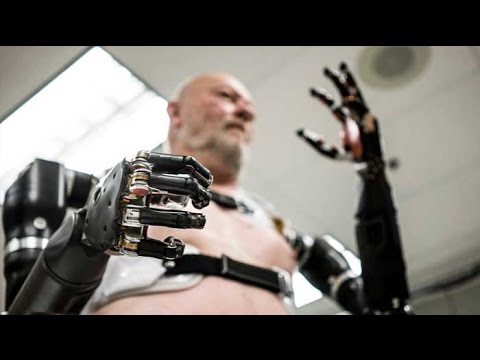 O melhor braço biônico do mundo #mundoalien