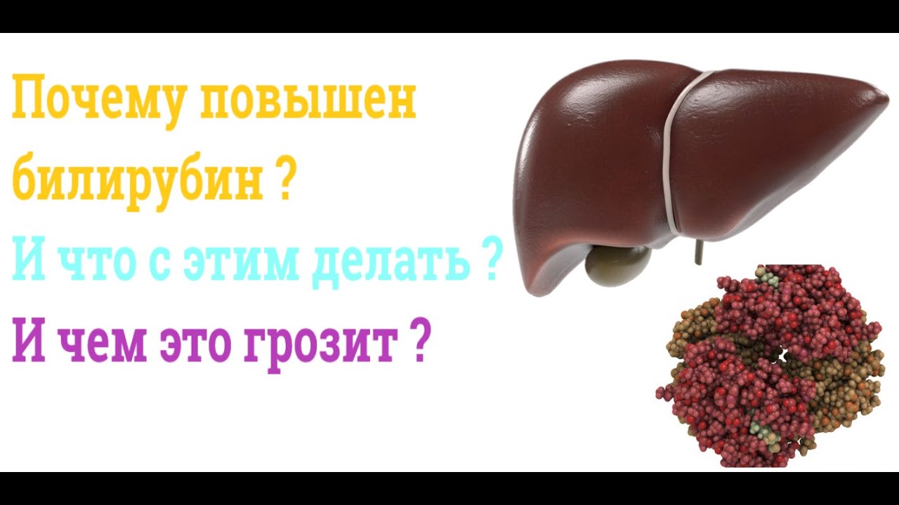 почему повышен билирубин и что с этим делать 