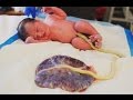 Arizona parents keep placenta attached to baby after birth Arizona parents keep placenta attached to baby after birth