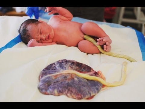 Arizona parents keep placenta attached to baby after birth