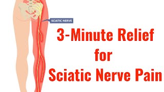 3 of the Best Exercises for Relief of Sciatic Nerv