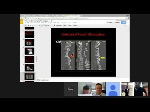 Primer on Cervical Spine Trauma