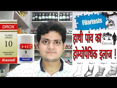 download lagu mp3 mp4 Filariasis Treatment In Homeopathy, download mp3 Filariasis Treatment In Homeopathy free downloadn, video klip Filariasis Treatment In Homeopathy