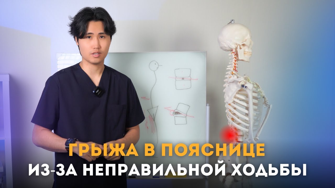 ГРЫЖА В ПОЯСНИЦЕ ИЗ-ЗА НЕПРАВИЛЬНОЙ ХОДЬБЫ. ЛУШИЕ УПРАЖНЕНИЯ ОТ ГРЫЖИ.