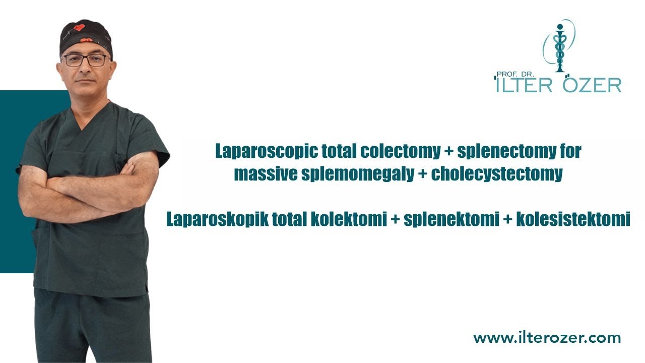 Laparoscopic total colectomy - splenectomy for massive splemomegaly - cholecystectomy