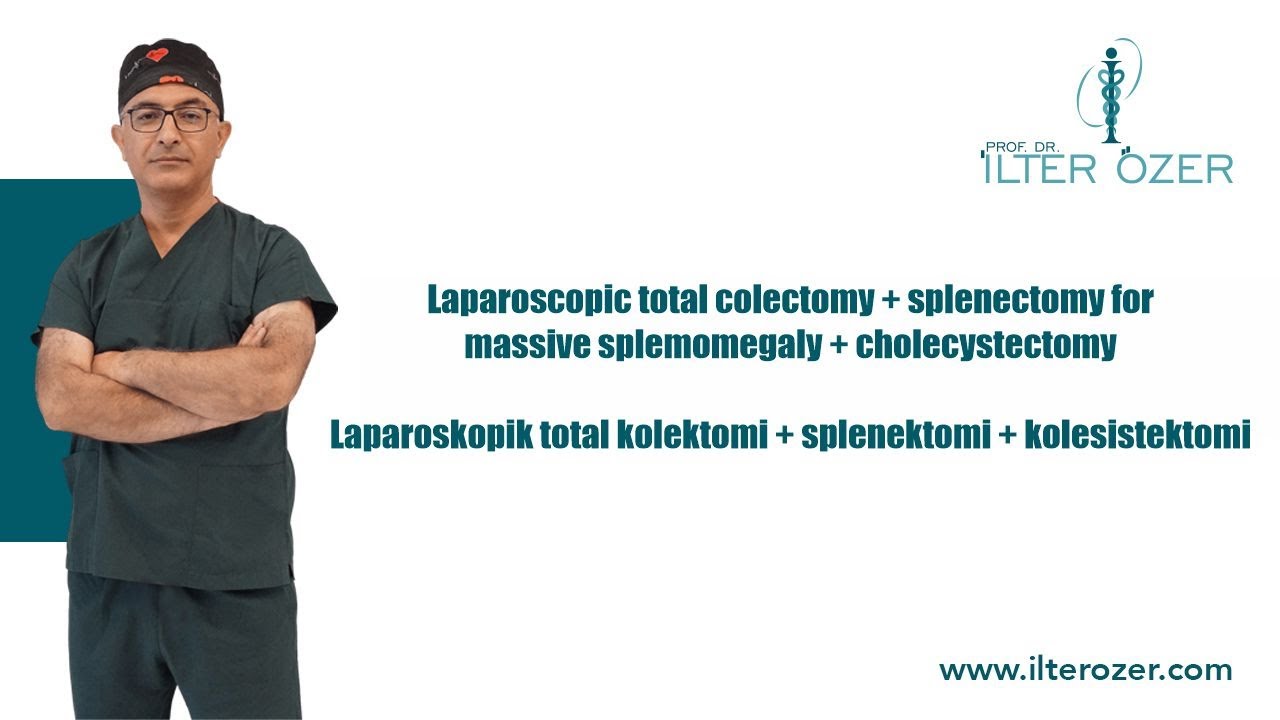 Laparoscopic total colectomy + splenectomy for massive splemomegaly + cholecystectomy