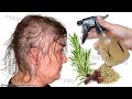 150 times stronger than onion and garlic!!! Hair grows extremely fast!!! rosemary for hair growth