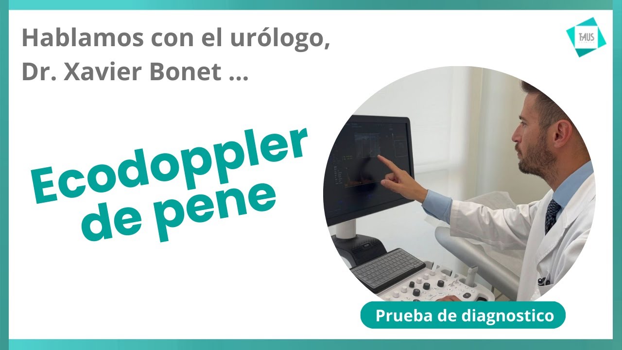 Xavier Bonet Puntí-32