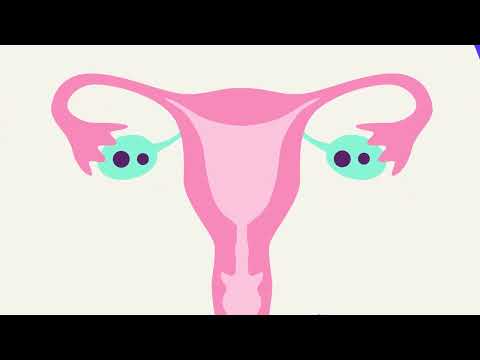 Vaginal ring contraceptive method: How does it work to prevent pregnancy?