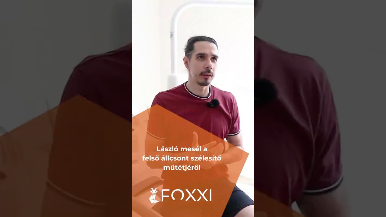 László túl van a felső állcsont szélesítésén