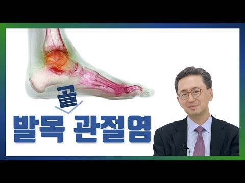 발목관절염 바로 알기