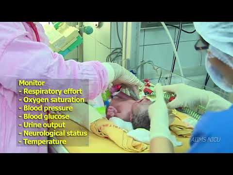 Post resuscitation care