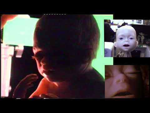 MAKING OF MASSIVE ATTACK TEAR DROP