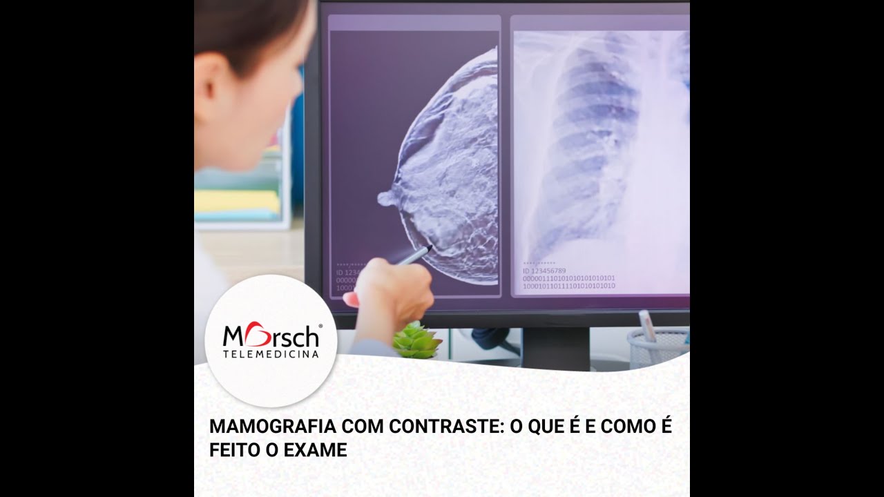 MAMOGRAFIA COM CONTRASTE: O QUE É E COMO É FEITO O EXAME