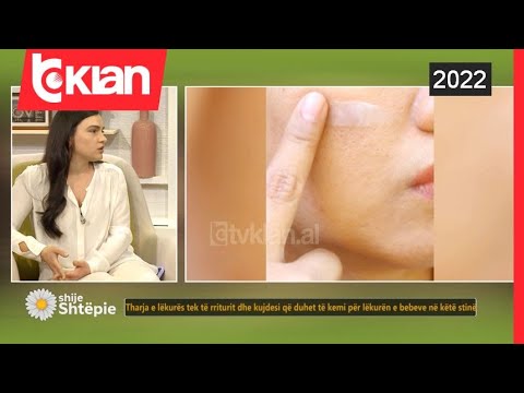 Shije Shtëpie - Lëkura e thatë gjatë dimrit? Ja disa këshilla për të rriturit dhe bebet - Tv Klan