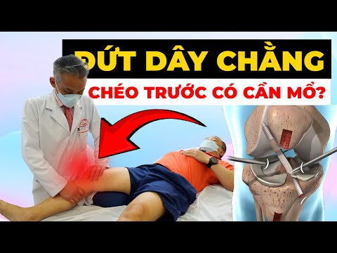 Đứt Dây Chằng Chéo Trước Có PHẢI Mổ Không? Bác Sĩ Chỉ Ra Sự Thật