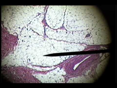 Slide 26 - Adipose Unilocular Fat