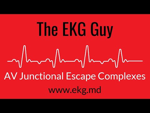 AV Junctional Escape Complexes EKG l The EKG Guy - www.ekg.md